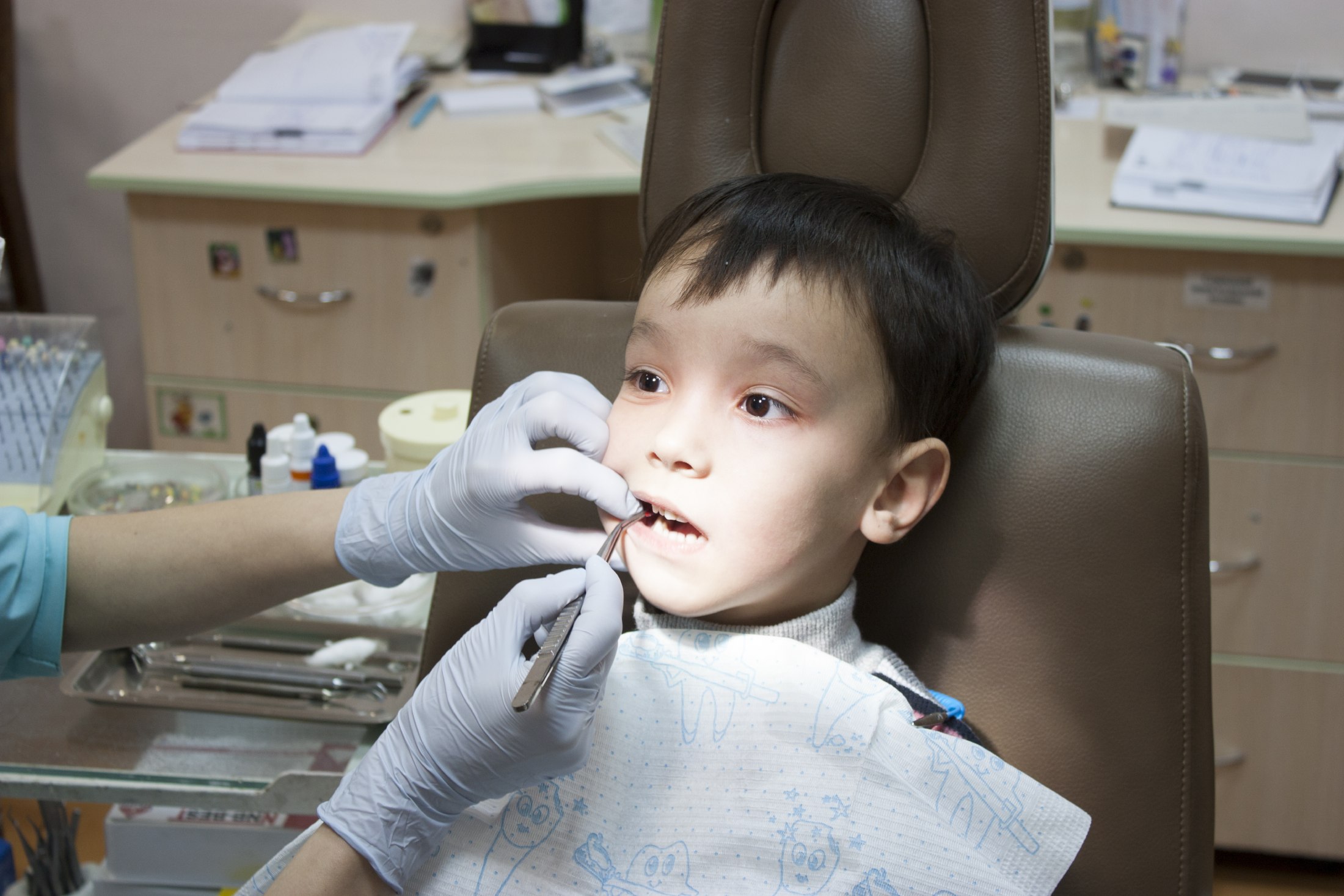 лечить или удалять молочные зубы?