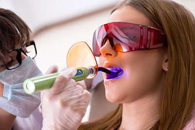 методы наращивания зубов