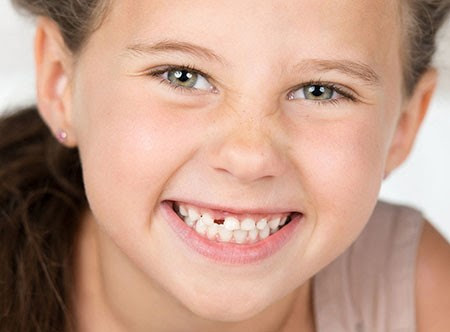 реставрация зубов у детей