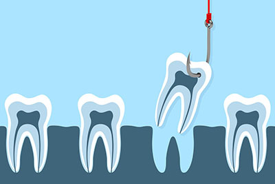 причины удаления зуба